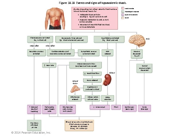 Figure 18. 18 Events and signs of hypovolemic shock. Acute bleeding (or other events