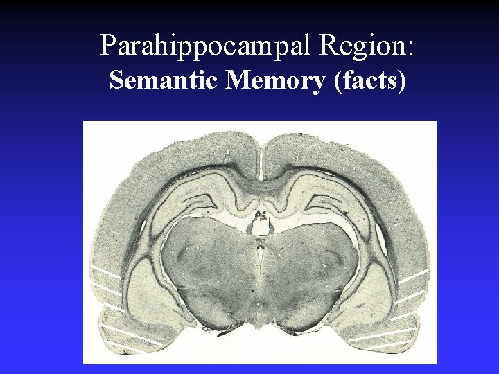 Parahippocampal Region: Semantic Memory (facts) Parahippocampal Region: Semantic Memory (facts)