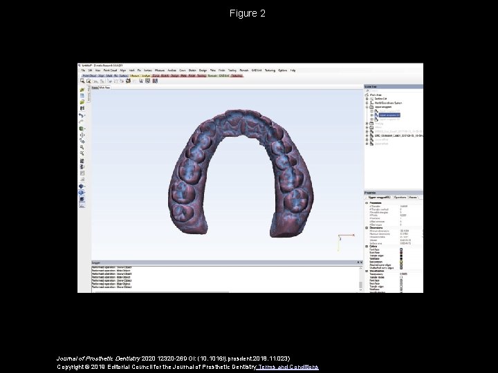 Figure 2 Journal of Prosthetic Dentistry 2020 12320 -26 DOI: (10. 1016/j. prosdent. 2018.