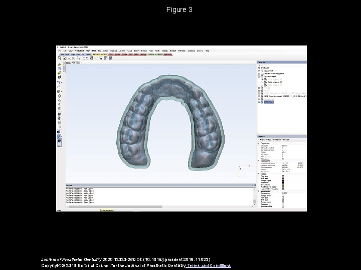 Figure 3 Journal of Prosthetic Dentistry 2020 12320 -26 DOI: (10. 1016/j. prosdent. 2018.