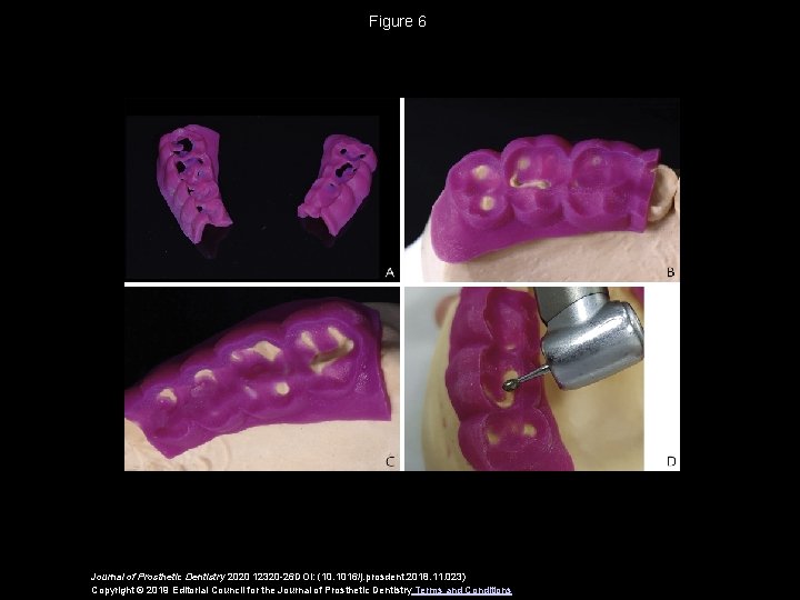 Figure 6 Journal of Prosthetic Dentistry 2020 12320 -26 DOI: (10. 1016/j. prosdent. 2018.