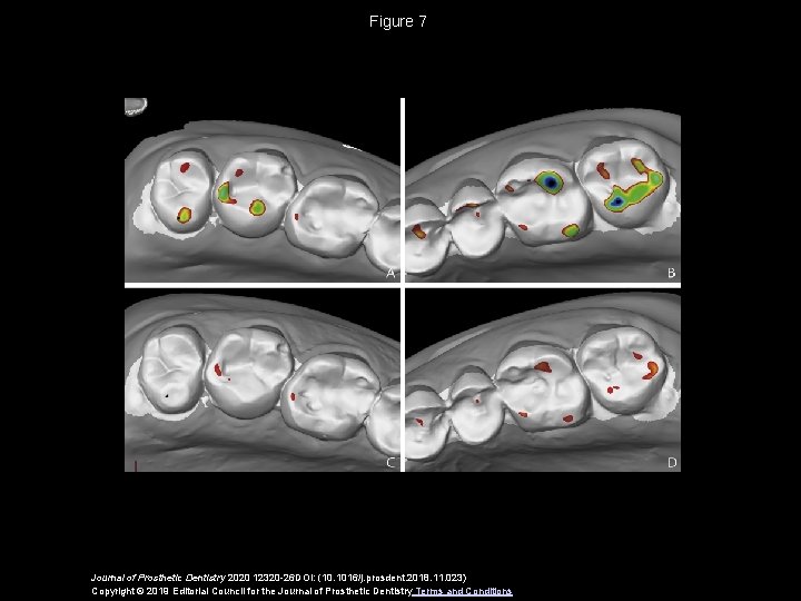 Figure 7 Journal of Prosthetic Dentistry 2020 12320 -26 DOI: (10. 1016/j. prosdent. 2018.