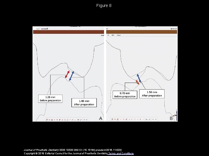 Figure 8 Journal of Prosthetic Dentistry 2020 12320 -26 DOI: (10. 1016/j. prosdent. 2018.