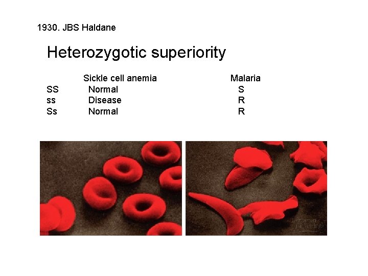 1930. JBS Haldane Heterozygotic superiority SS ss Ss Sickle cell anemia Normal Disease Normal