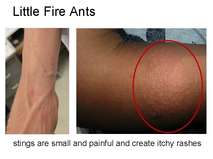 Little Fire Ants stings are small and painful and create itchy rashes Little Fire Ants stings are small and painful and create itchy rashes