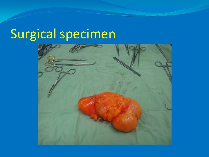 Surgical specimen 