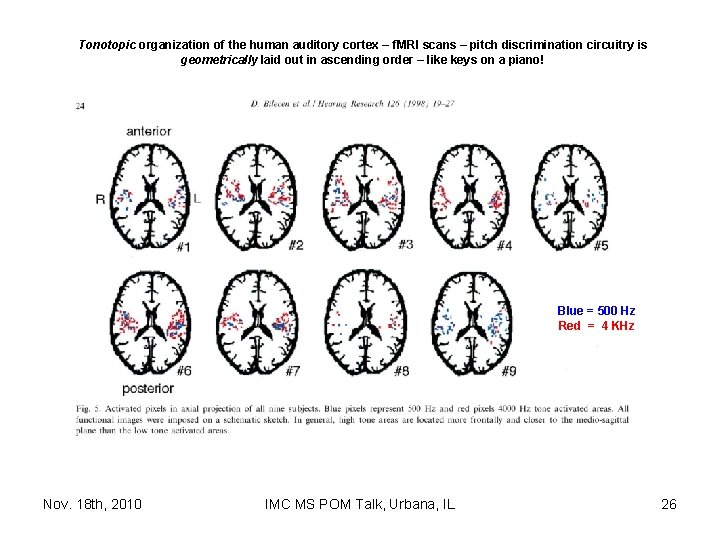 Tonotopic organization of the human auditory cortex – f. MRI scans – pitch discrimination