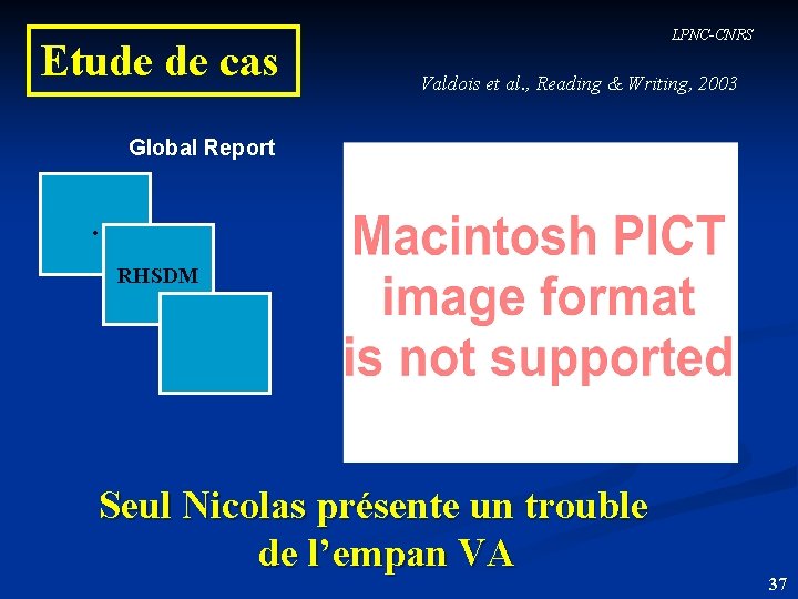  Etude de cas LPNC-CNRS Valdois et al. , Reading & Writing, 2003 Global