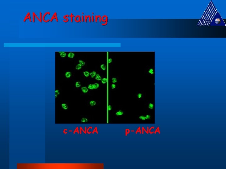 ANCA staining c-ANCA p-ANCA 