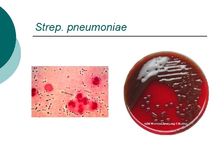 Strep. pneumoniae 