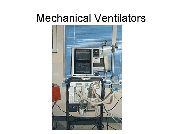 Mechanical Ventilators 