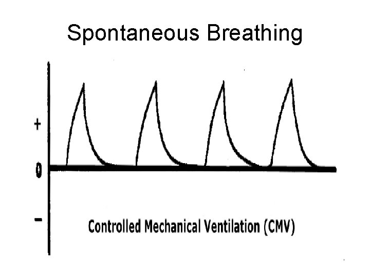 Spontaneous Breathing 