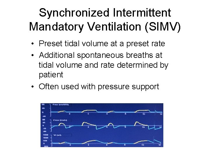 Synchronized Intermittent Mandatory Ventilation (SIMV) • Preset tidal volume at a preset rate •