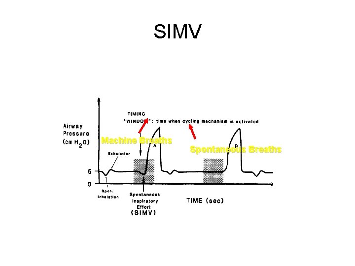 SIMV Machine Breaths Spontaneous Breaths 