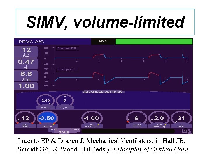 SIMV, volume-limited Ingento EP & Drazen J: Mechanical Ventilators, in Hall JB, Scmidt GA,