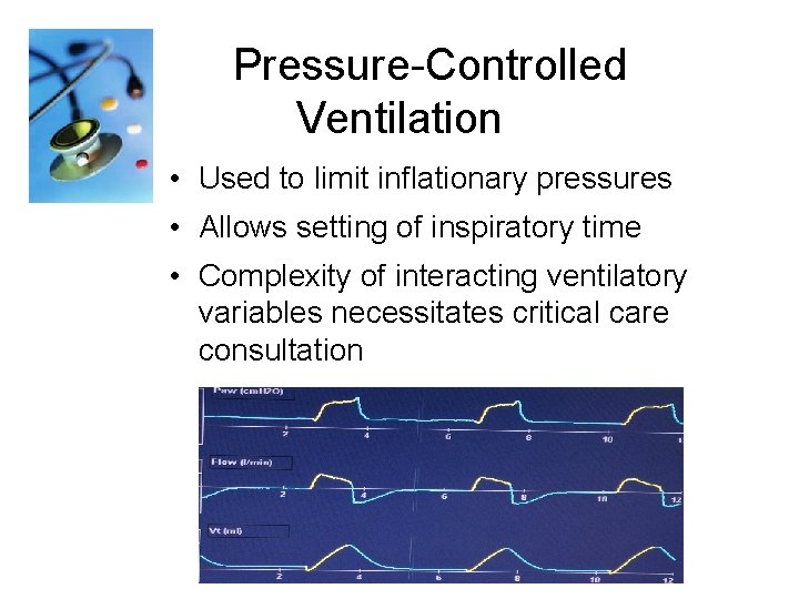  Pressure-Controlled Ventilation • Used to limit inflationary pressures • Allows setting of inspiratory