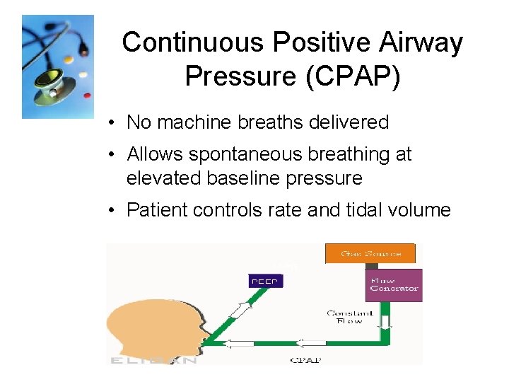 Continuous Positive Airway Pressure (CPAP) • No machine breaths delivered • Allows spontaneous breathing
