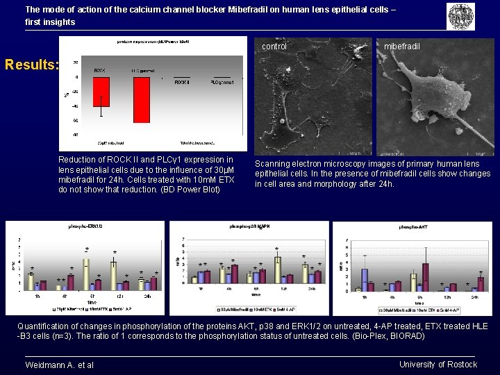 The mode of action of the calcium channel blocker Mibefradil on human lens epithelial The mode of action of the calcium channel blocker Mibefradil on human lens epithelial