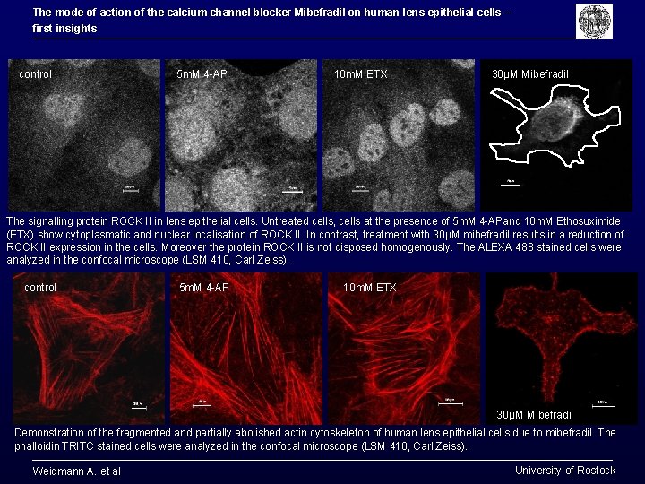 The mode of action of the calcium channel blocker Mibefradil on human lens epithelial The mode of action of the calcium channel blocker Mibefradil on human lens epithelial