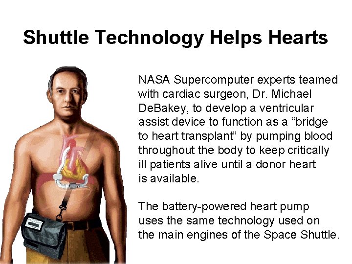 Shuttle Technology Helps Hearts NASA Supercomputer experts teamed with cardiac surgeon, Dr. Michael De. Shuttle Technology Helps Hearts NASA Supercomputer experts teamed with cardiac surgeon, Dr. Michael De.