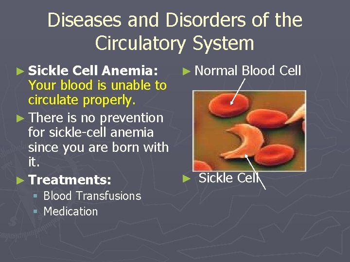 Diseases and Disorders of the Circulatory System ► Sickle Cell Anemia: ► Normal Blood