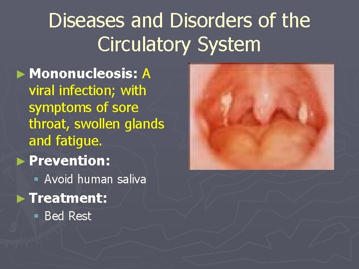 Diseases and Disorders of the Circulatory System ► Mononucleosis: A viral infection; with symptoms