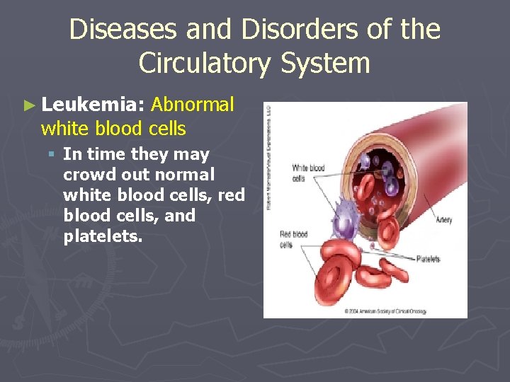 Diseases and Disorders of the Circulatory System ► Leukemia: Abnormal white blood cells §