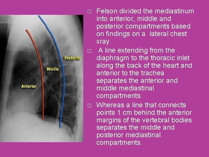 � � � Felson divided the mediastinum into anterior, middle and posterior compartments based