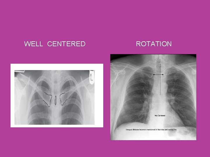 WELL CENTERED ROTATION 