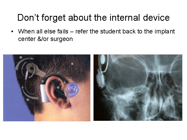 Don’t forget about the internal device • When all else fails – refer the