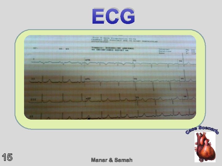 ECG 15 Manar & Samah 