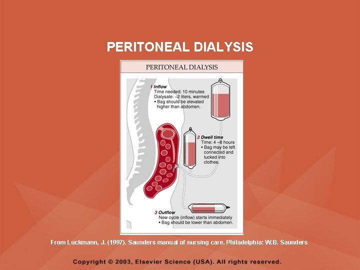 PERITONEAL DIALYSIS From Luckmann, J. (1997). Saunders manual of nursing care. Philadelphia: W. B.