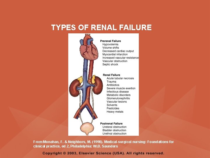 TYPES OF RENAL FAILURE From Monahan, F. & Neighbors, M. (1998). Medical-surgical nursing: Foundations