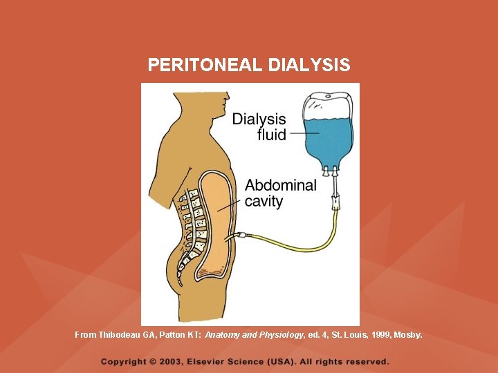 PERITONEAL DIALYSIS From Thibodeau GA, Patton KT: Anatomy and Physiology, ed. 4, St. Louis,
