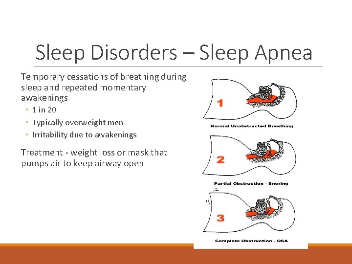 Sleep Disorders – Sleep Apnea Temporary cessations of breathing during sleep and repeated momentary