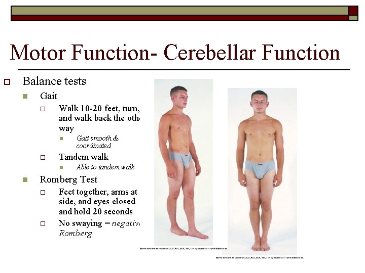 Motor Function- Cerebellar Function o Balance tests n Gait o Walk 10 -20 feet,