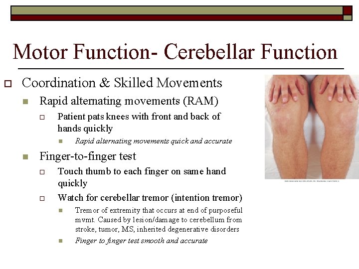 Motor Function- Cerebellar Function o Coordination & Skilled Movements n Rapid alternating movements (RAM)