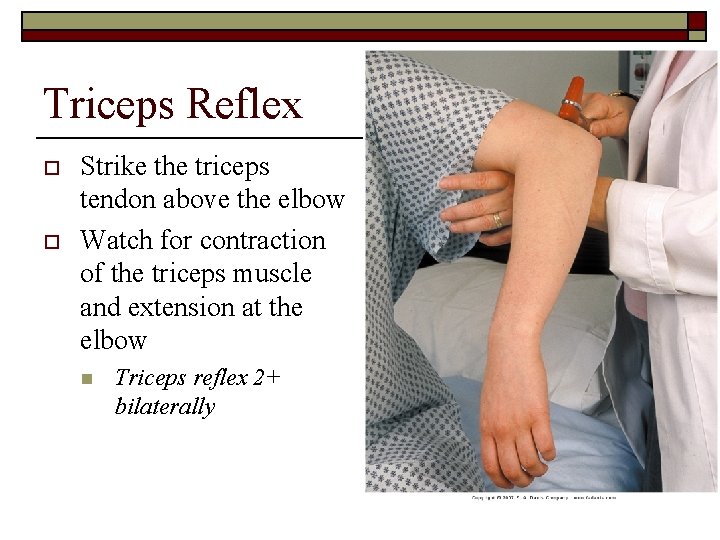 Triceps Reflex o o Strike the triceps tendon above the elbow Watch for contraction