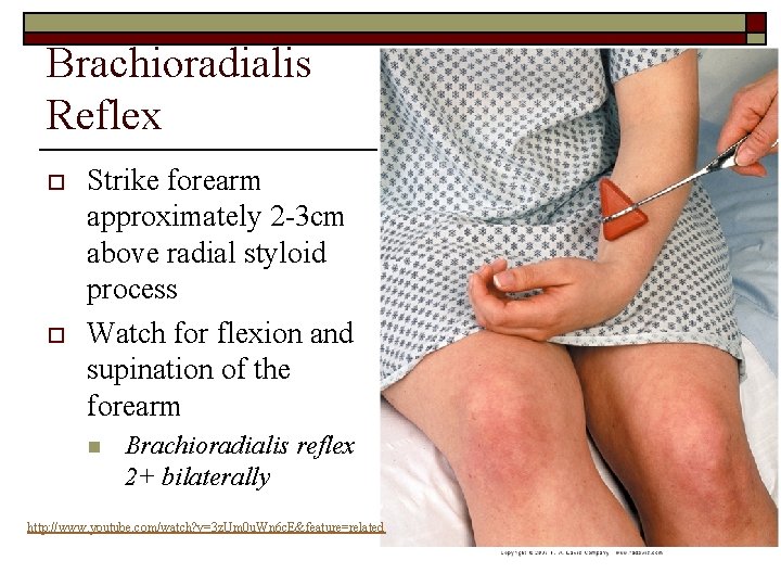 Brachioradialis Reflex o o Strike forearm approximately 2 -3 cm above radial styloid process