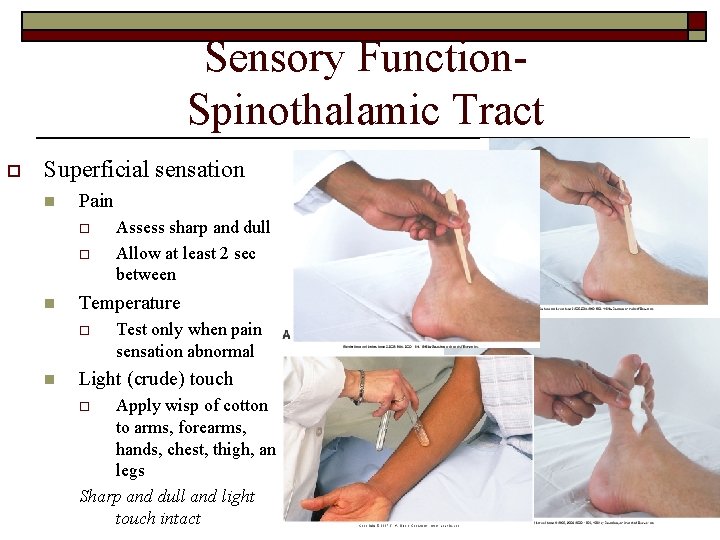 Sensory Function. Spinothalamic Tract o Superficial sensation n Pain o o n Temperature o