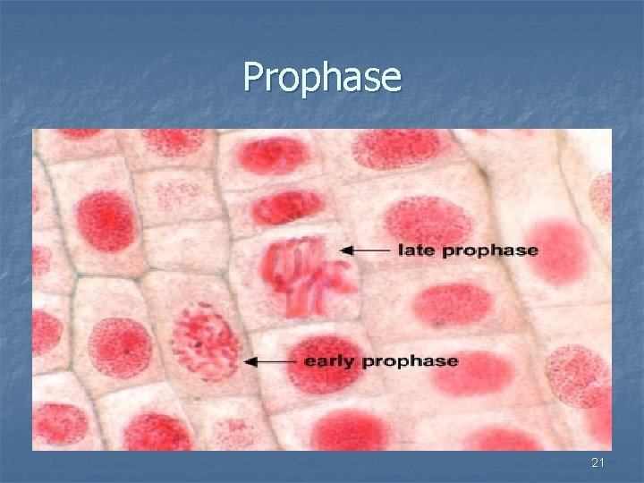 Prophase 21 