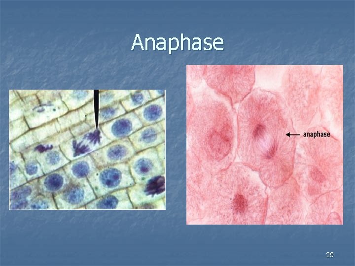 Anaphase 25 