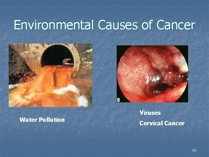 Environmental Causes of Cancer Water Pollution Viruses Cervical Cancer 44 