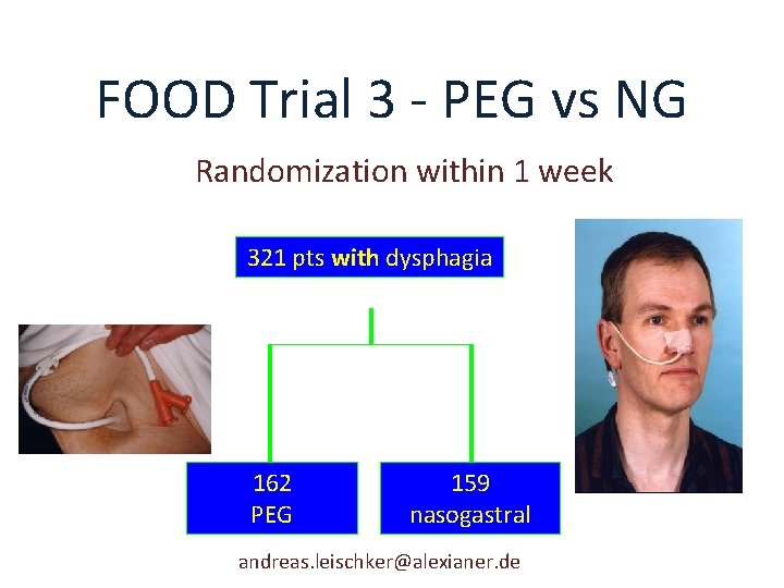 FOOD Trial 3 - PEG vs NG Randomization within 1 week 321 pts with