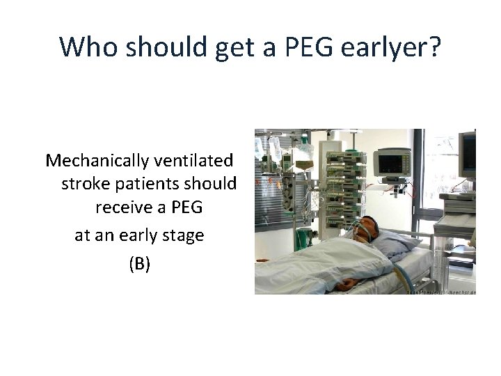 Who should get a PEG earlyer? Mechanically ventilated stroke patients should receive a PEG