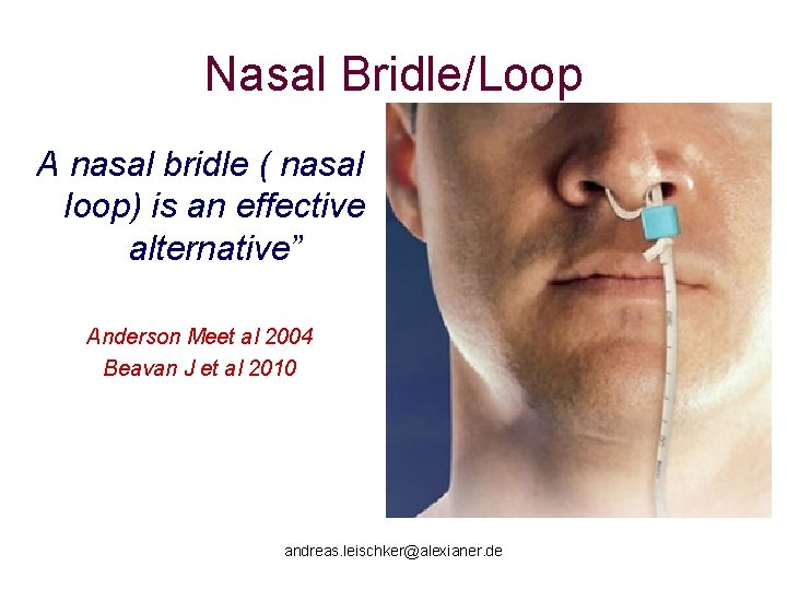 Nasal Bridle/Loop A nasal bridle ( nasal loop) is an effective alternative” Anderson Meet