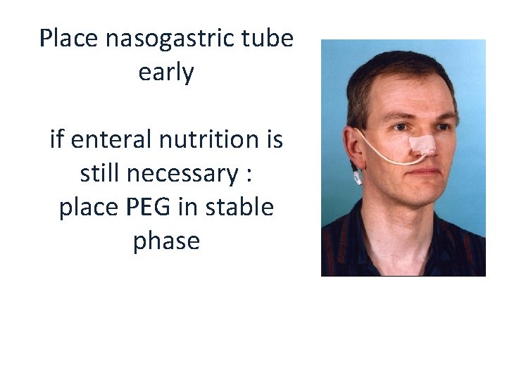 Place nasogastric tube early if enteral nutrition is still necessary : place PEG in