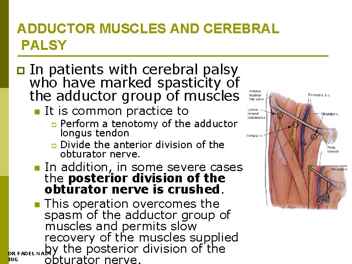 ADDUCTOR MUSCLES AND CEREBRAL PALSY p In patients with cerebral palsy who have marked