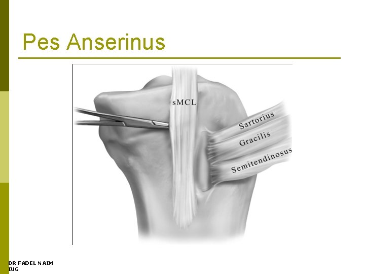 Pes Anserinus DR FADEL NAIM IUG 