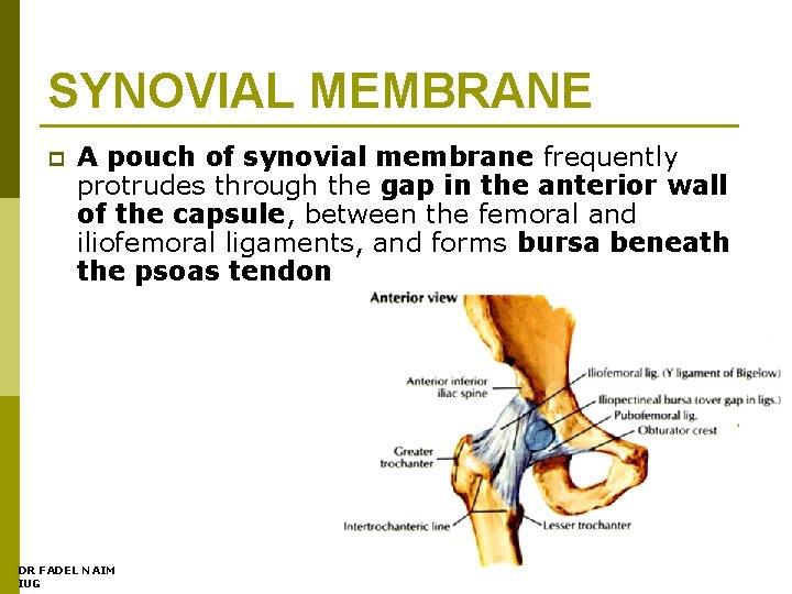 SYNOVIAL MEMBRANE p A pouch of synovial membrane frequently protrudes through the gap in